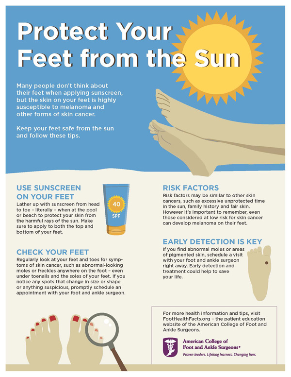 protectfeetsun-infographic.jpeg